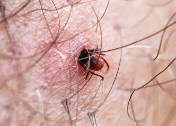 Picaduras de garrapatas: cómo prevenir la enfermedad de Lyme, que puede causar discapacidad
