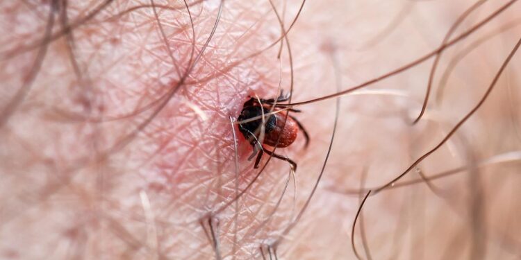 Picaduras de garrapatas: cómo prevenir la enfermedad de Lyme, que puede causar discapacidad