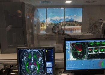 HIFU, así es la increíble técnica que fulmina los temblores: ‘Hay pacientes que lloran al ver que pueden volver a comer solos’