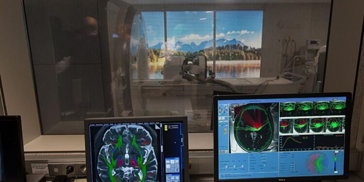 HIFU, así es la increíble técnica que fulmina los temblores: ‘Hay pacientes que lloran al ver que pueden volver a comer solos’