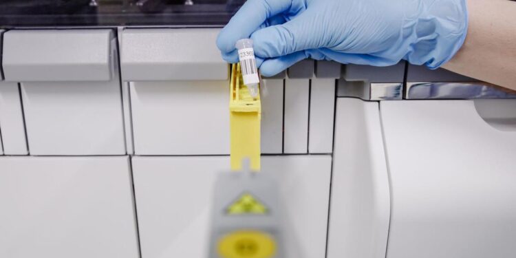 Madrid, Cataluña, Andalucía…las comunidades quieren más vacunas para frenar la viruela del mono