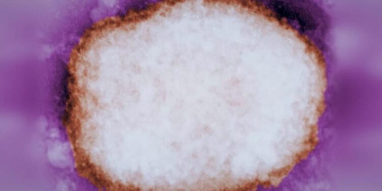 Los especialistas rebajan la alarma por la viruela del mono: ‘Esto no es el covid, no es una pandemia’