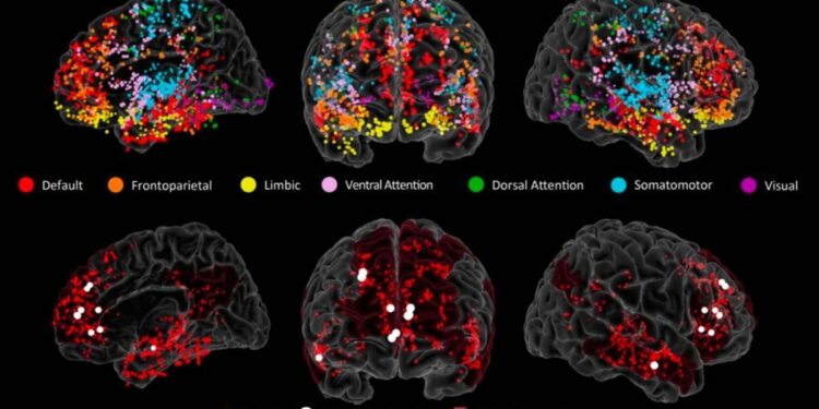 Revelan la red neuronal que gestiona la creatividad en el cerebro