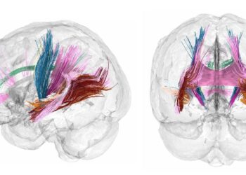 Por qué la neurociencia del embarazo no debería considerarse un tema de investigación de nicho