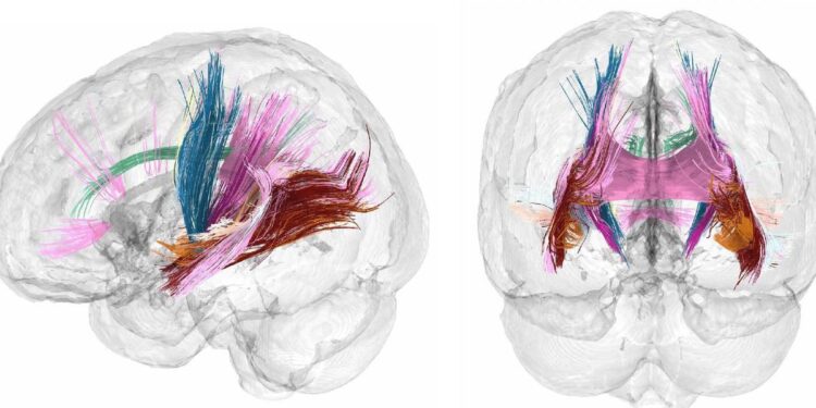 Por qué la neurociencia del embarazo no debería considerarse un tema de investigación de nicho