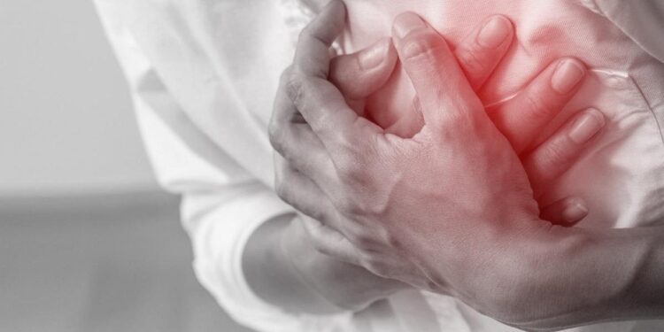 El infarto de miocardio mata 5 veces más en pacientes con COVID-19 que sin infección