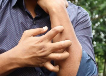 Micosis fungoide: así es el cáncer raro que se confunde con otras enfermedades de la piel