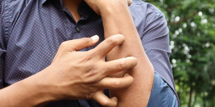 Micosis fungoide: así es el cáncer raro que se confunde con otras enfermedades de la piel