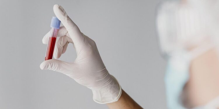 Anemia: causas, síntomas, tratamiento y a quién afecta este trastorno común de la sangre