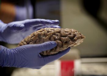 La mitad de las personas que están comenzando a padecer alzhéimer todavía no lo saben