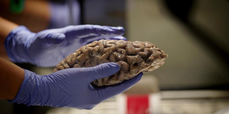 La mitad de las personas que están comenzando a padecer alzhéimer todavía no lo saben