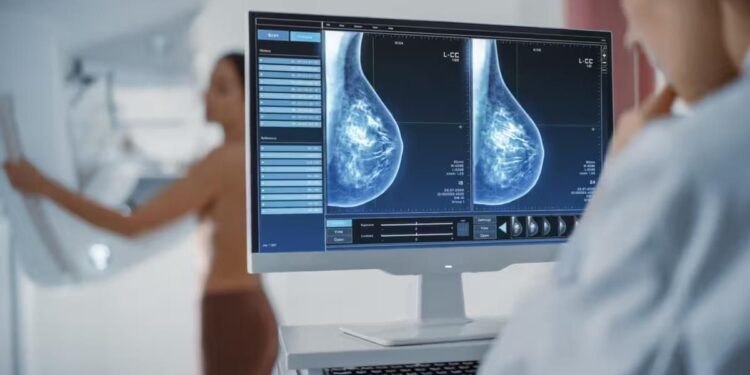 Cómo la IA está transformando el cáncer: medicina personalizada y menos efectos secundarios