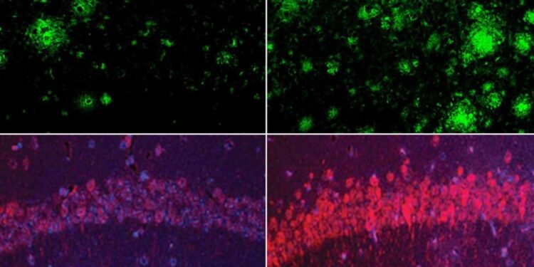 El litio, una nueva esperanza para revertir el alzhéimer