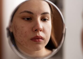 Cómo cuidar tu piel si tienes acné en verano: protector solar, hidratación y productos que sí funcionan