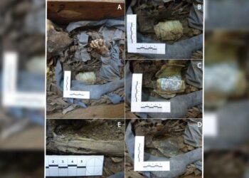 El Madrid del siglo XIX: cómo se trataba la enfermedad y la muerte