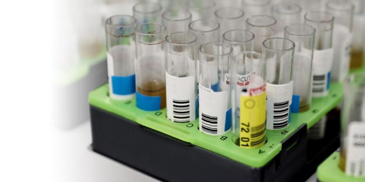 Madrid detecta el primer contagio autóctono de la variante más grave de la viruela del mono