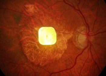 Un revolucionario chip logra restaurar la visión humana